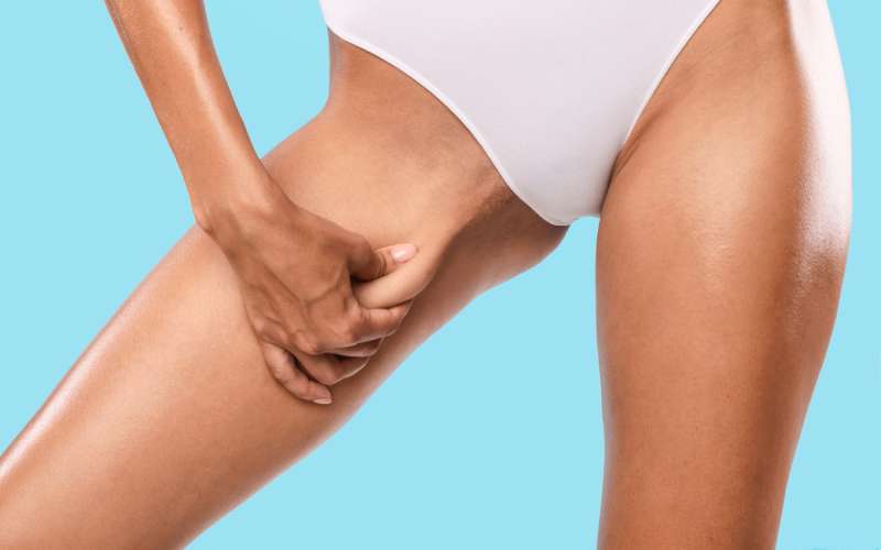 ขาหนีบเสียดสี ขาหนีบดำ มีวิธีแก้ไขอย่างไร?